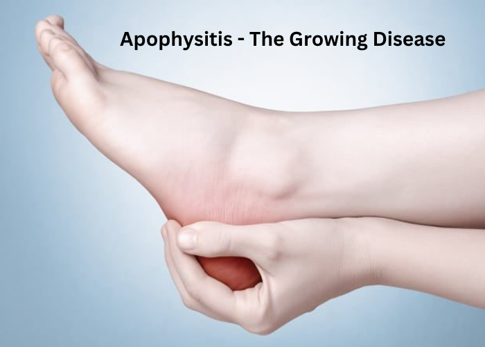 Apophysitis